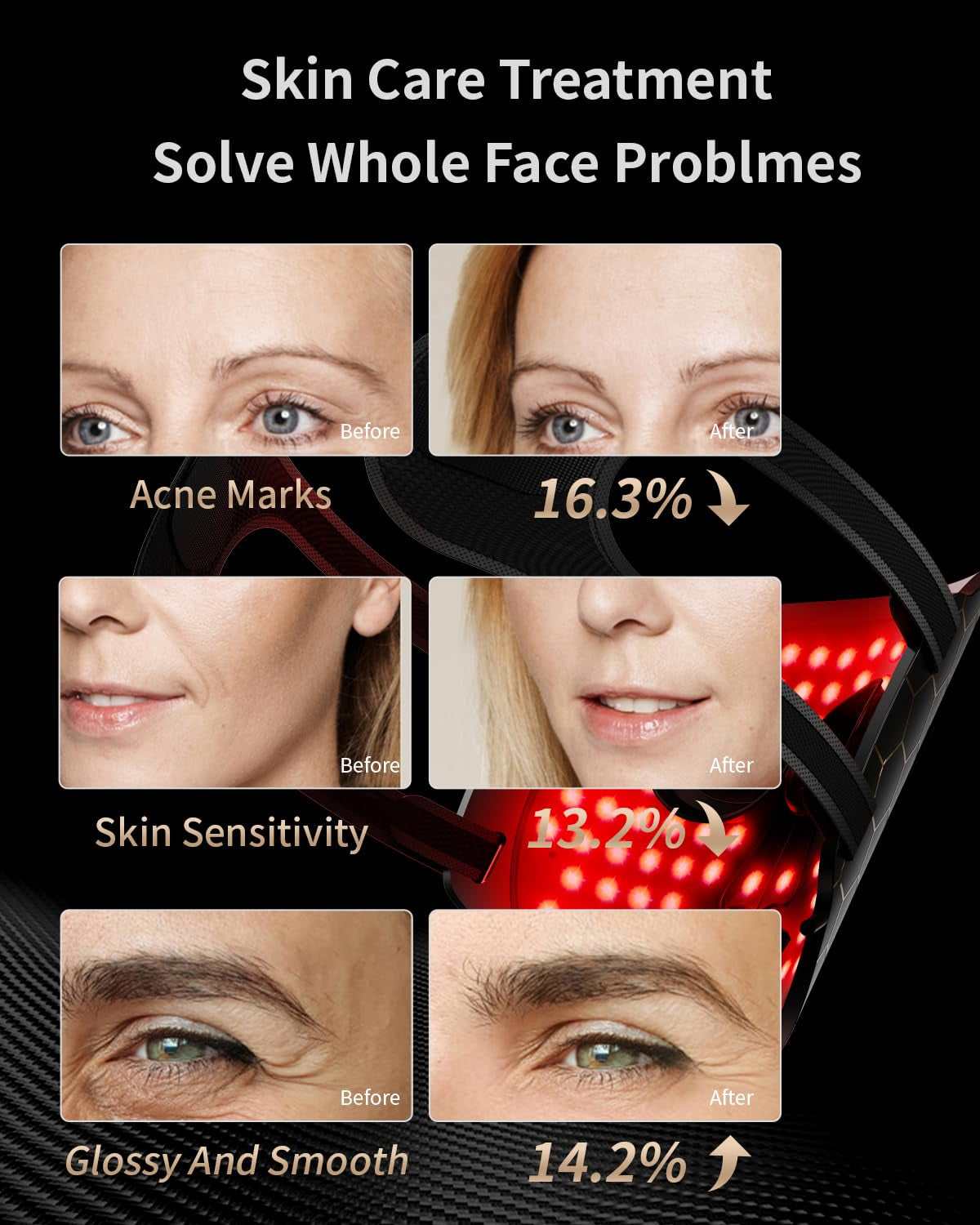 Face  Light 7 Colors Facial  Anti-Aging Tightening Skin (Black)